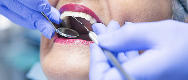 Best Emergency Root Canal Treatment in Mentone, IN